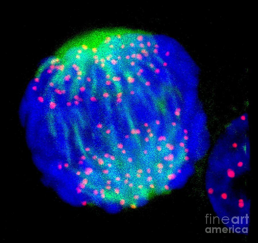 Human Cell In Anaphase #2 Photograph by Dr Matthew Daniels/science Photo Library