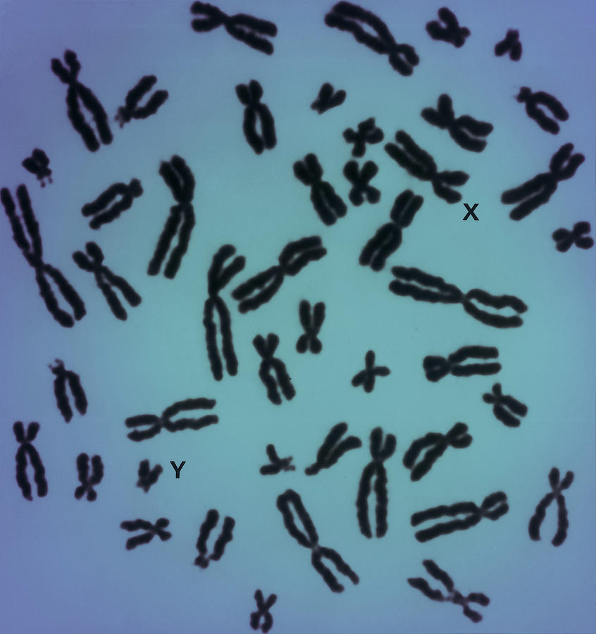 Human Chromosomes Photograph By Biophoto Associates Fine Art America 5426