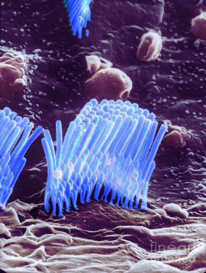 Human Ear Hair Cell #2 Photograph by Professor Tony Wright, Institute Of Laryngology & Otology/science Photo Library