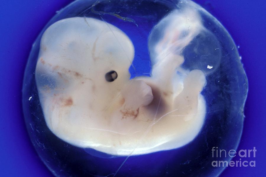 Human Embryo At 40 Days. Lm #2 Photograph by Carolina Biological Supply Company/science Photo Library