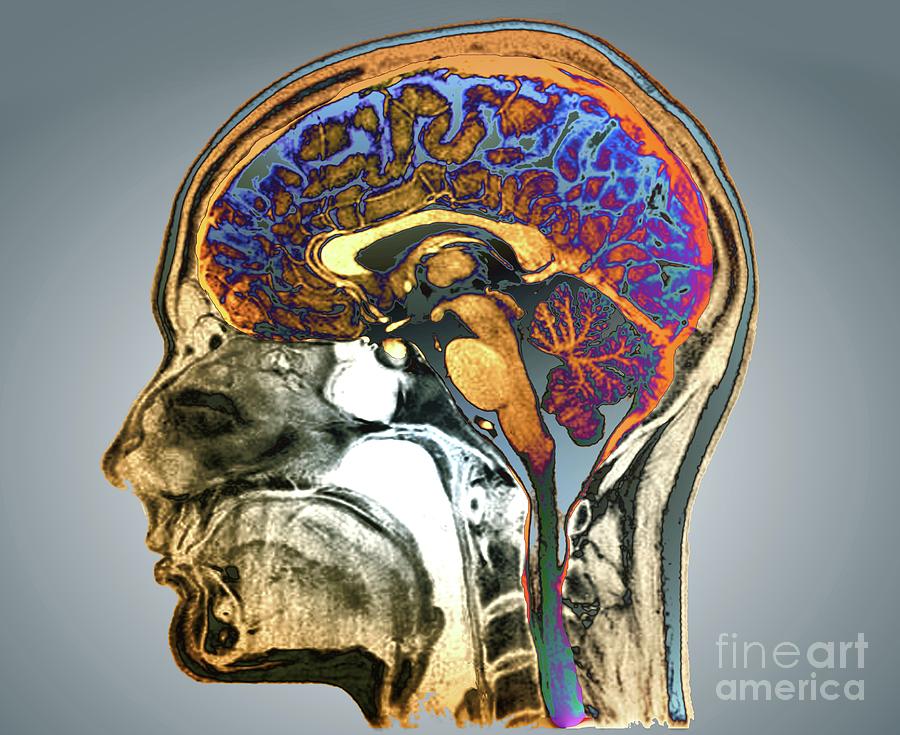 Human Head And Brain #2 Photograph by Zephyr/science Photo Library