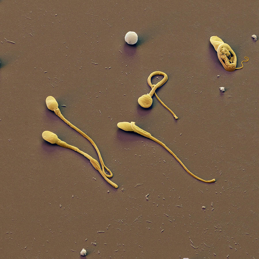 Human Sperm Cells #2 Photograph by Meckes/ottawa