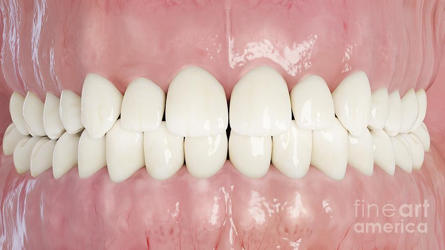 Human Teeth Photograph by Sebastian Kaulitzki/science Photo Library ...