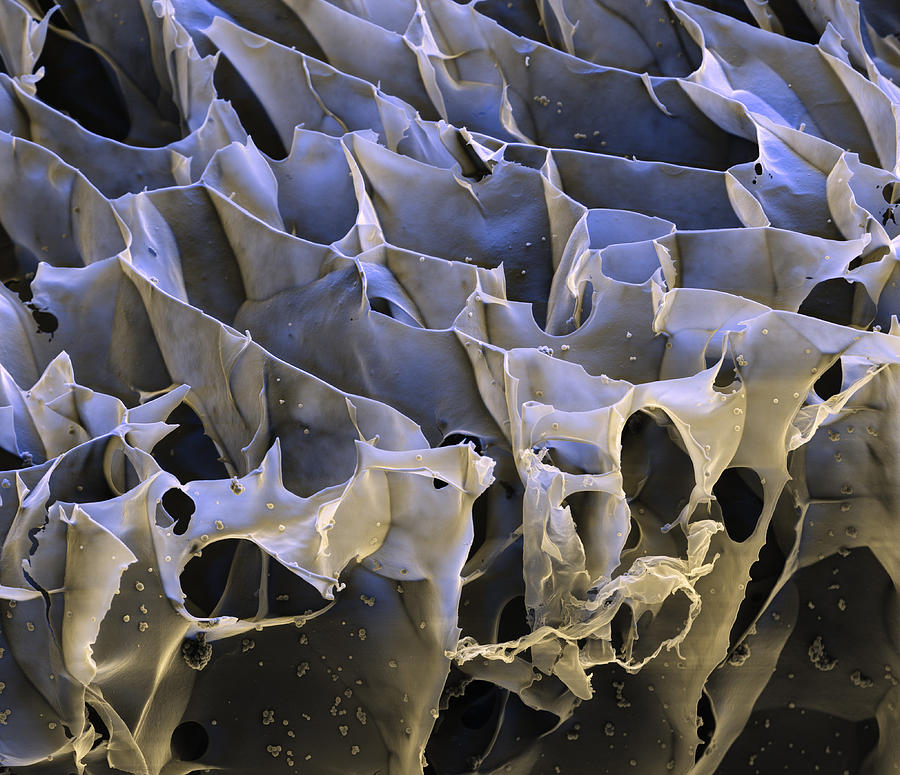 Hydrogel Of Synthetic Spider Silk, Sem #2 Photograph by Meckes/ottawa