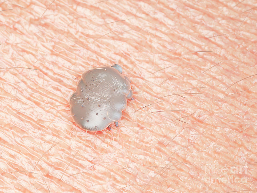 Illustration Of A Scabies Mite On Human Skin Photograph By Sebastian