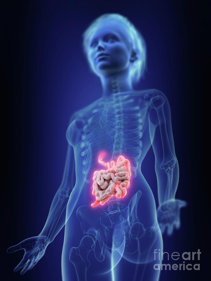 Illustration Of An Inflamed Small Intestine Photograph By Sebastian Kaulitzkiscience Photo Library 9866