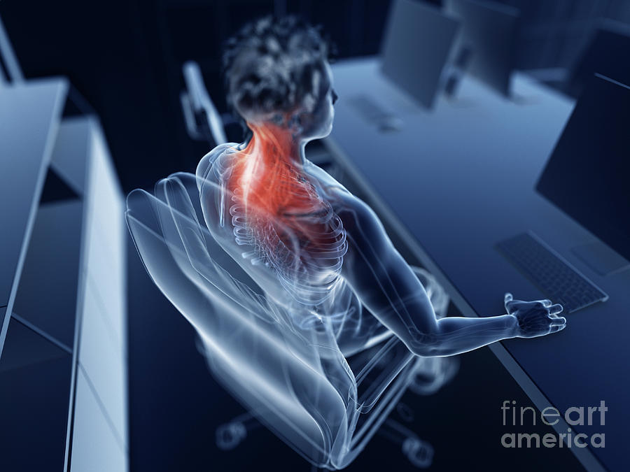 3d Photograph - Illustration Of An Office Workers Painful Muscles #2 by Sebastian Kaulitzki/science Photo Library