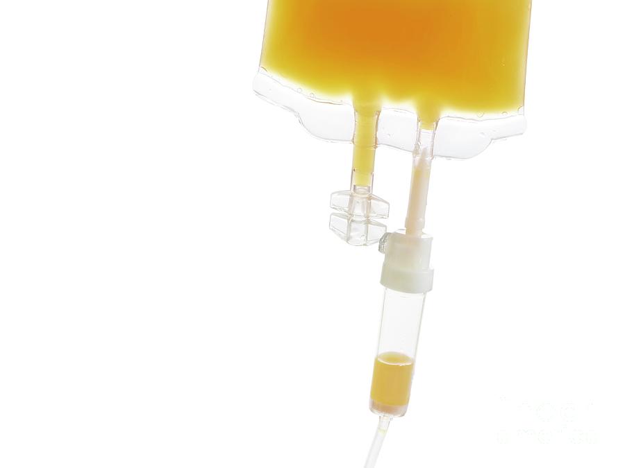 Iv Bag With Orange Juice #2 Photograph by Science Photo Library
