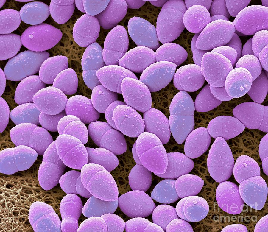 Kefir Bacteria #2 Photograph by Steve Gschmeissner/science Photo Library