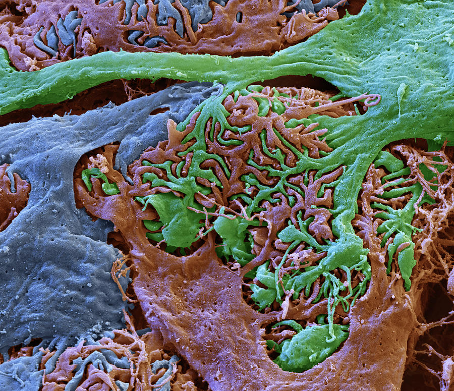 Kidney Glomerulus, Sem #2 Photograph by Oliver Meckes EYE OF SCIENCE