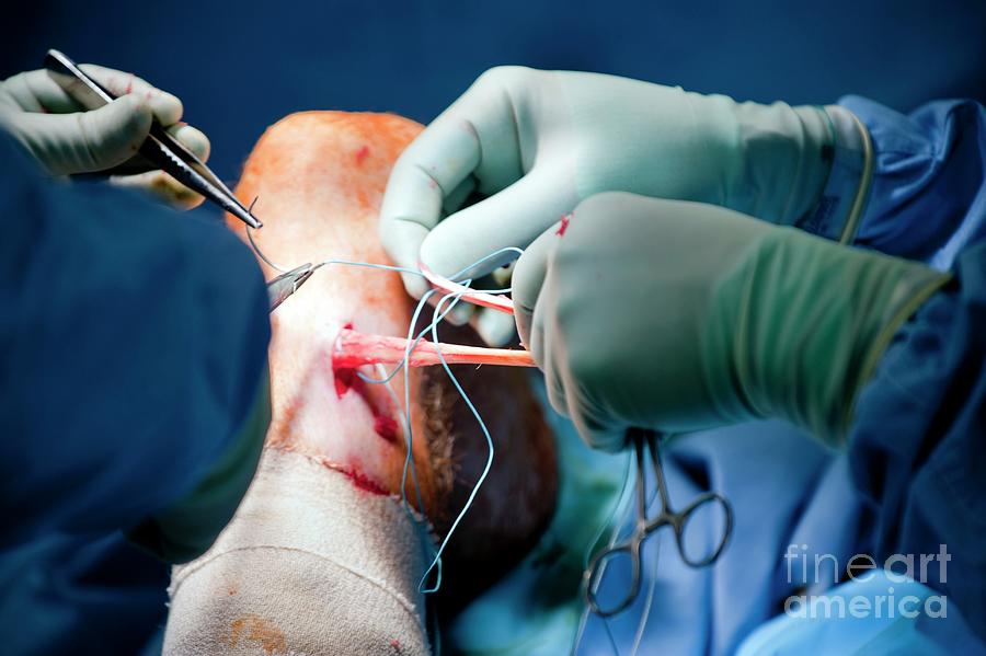 Knee Ligament Repair Surgery #2 Photograph by Jim Varney/science Photo Library