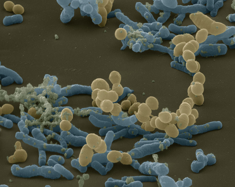 Lactic Acid Bacteria #2 Photograph by Meckes/ottawa