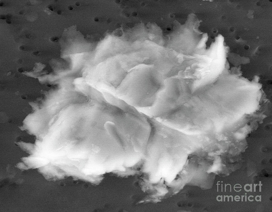 Lake Vostok Micro-organism #2 Photograph by Marshall Space Flight Center/nasa/science Photo Library