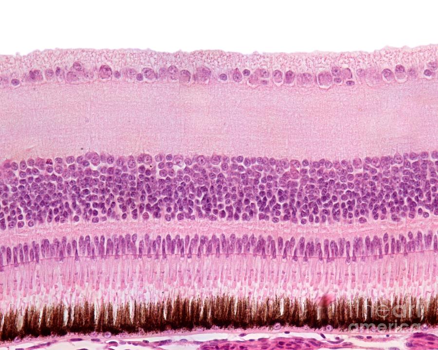 layers of the retina