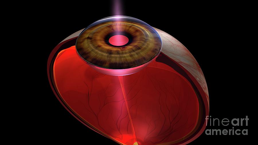 Light Entering Human Eye #2 Photograph by Norbert Zappold / Science Photo Library