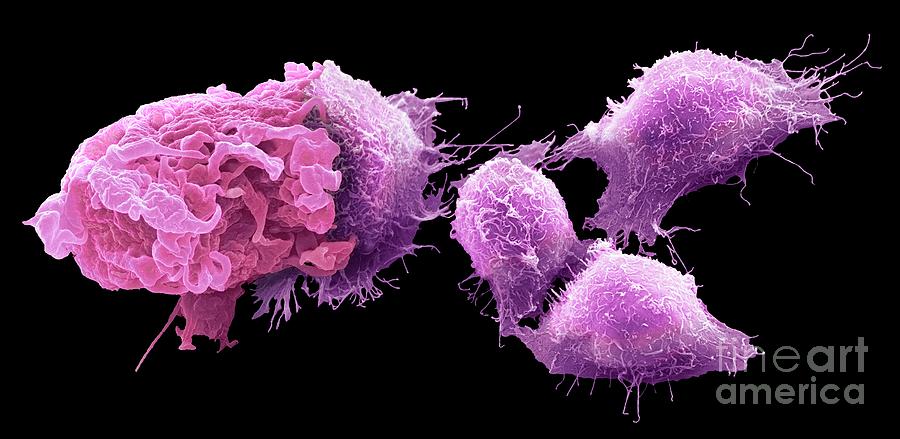 Macrophage And Cancer Cells #2 Photograph by Steve Gschmeissner/science Photo Library
