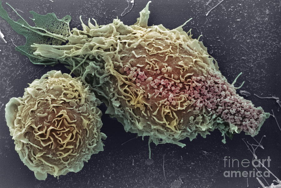 Macrophages #2 Photograph by A. Dowsett, National Infection Service/science Photo  Library