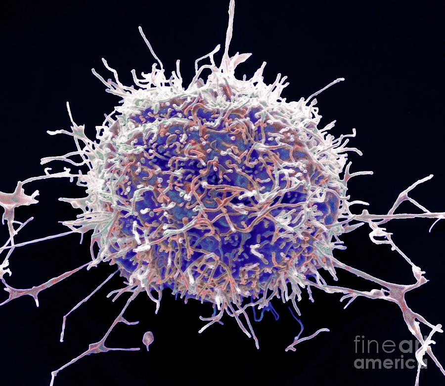 Mesothelioma Cancer Cell #2 Photograph by Steve Gschmeissner/science Photo Library