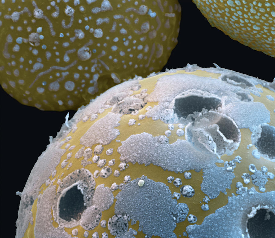 Milk Fat Droplets, Sem #2 Photograph by Eye Of Science