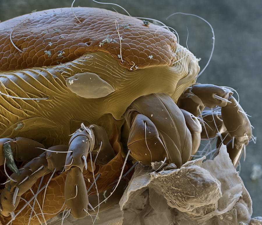 Mite On Anopheles Mosquito Larvae, Sem #2 Photograph by Meckes/ottawa
