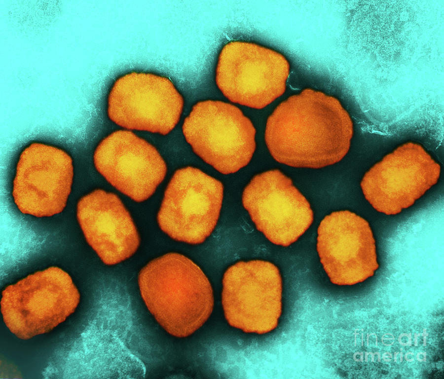 Monkeypox Virus Particles Photograph by National Institute Of Allergy ...