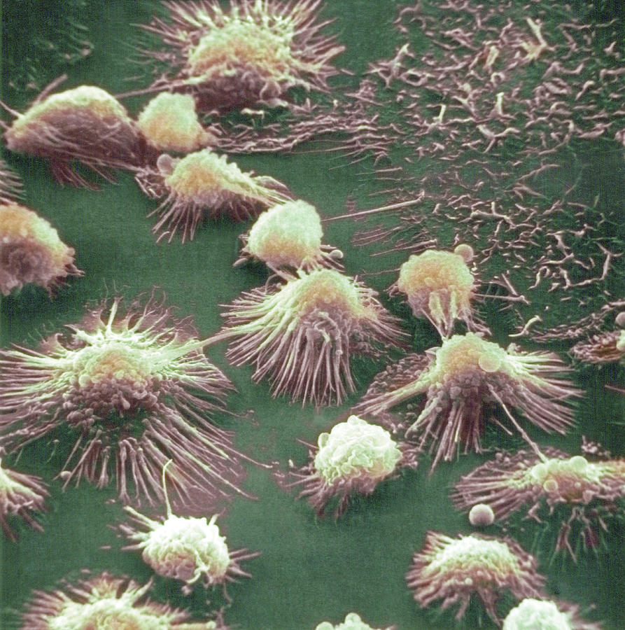 Monocytes, Sem #2 Photograph by Biophoto Associates