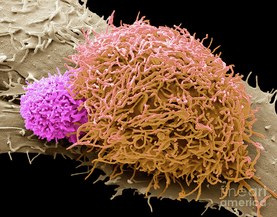 Natural Killer Cell And Cancer Cell Photograph by Steve Gschmeissner ...