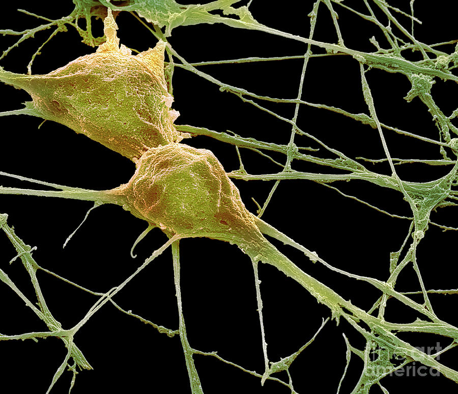 Neurons #2 Photograph by Steve Gschmeissner/science Photo Library