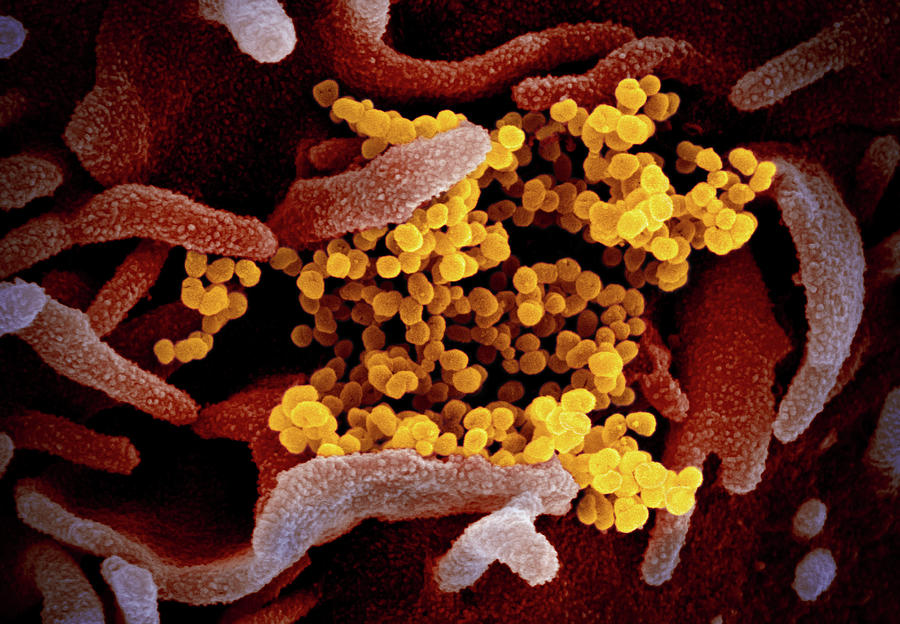 Novel Coronavirus Sars-cov-2 #2 Photograph by Science Source