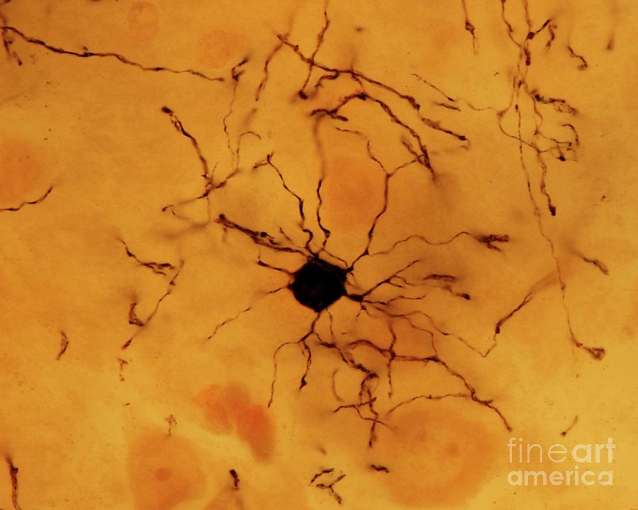 Oligodendroglia Photograph by Jose Calvo / Science Photo Library - Fine ...