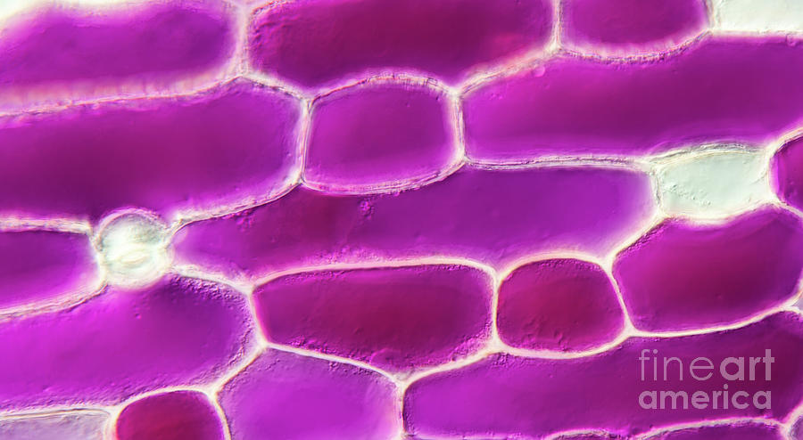 Onion Epidermis Plasmolysis #2 Photograph by Gerd Guenther/science Photo Library