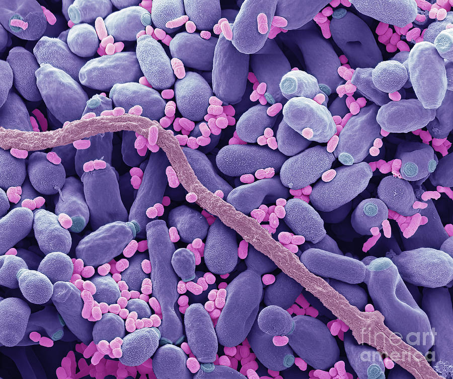 Oral Microbiota #2 Photograph by Steve Gschmeissner/science Photo Library