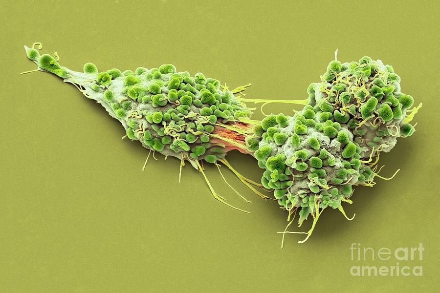 Ovarian Cancer Cells Photograph By Steve Gschmeissnerscience Photo Library Fine Art America 3826