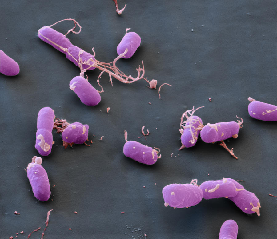 Plague Bacteria Yersinia Pestis, Sem #2 Photograph by Meckes/ottawa
