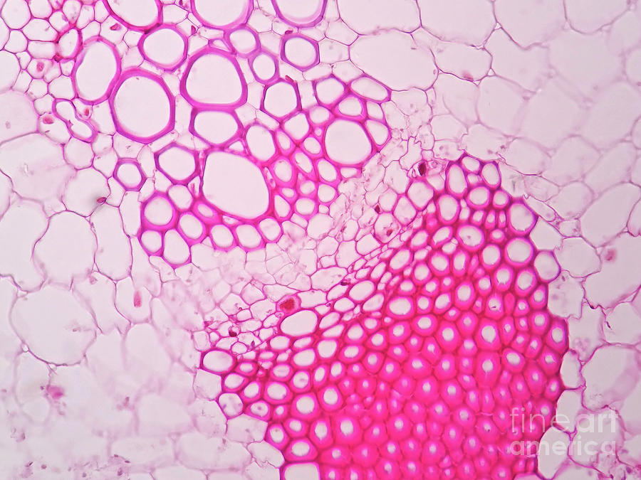 Plant Vascular Tissue Photograph By Choksawatdikorn Science Photo