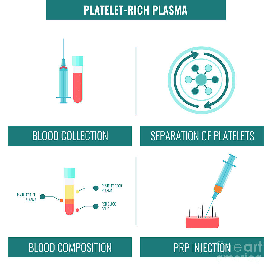 Prp Photograph - Platelet Rich Plasma Hair Treatment #2 by Art4stock/science Photo Library