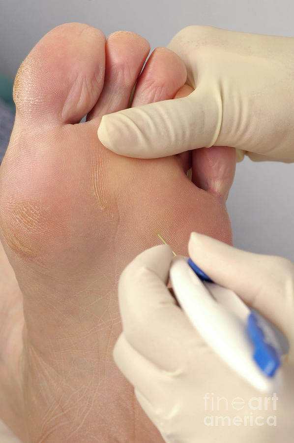 Podiatrist Performs A Foot Sensitivity Test On Her Patient #2 Photograph by Medicimage / Science Photo Library