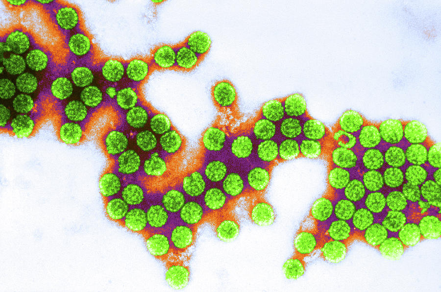 Polyoma Virus Sv40 Tem #2 Photograph by Science Source