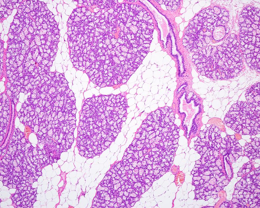 Pregnant Breast Tissue Photograph by Jose Calvo/science Photo Library