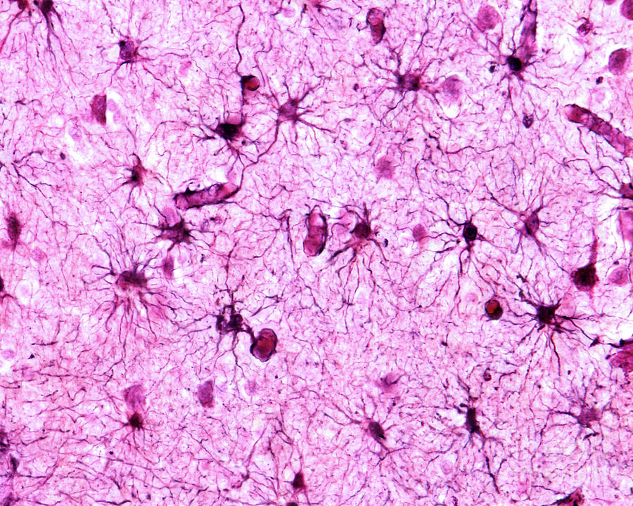 Protoplasmic Astrocytes #2 Photograph by Jose Calvo / Science Photo Library