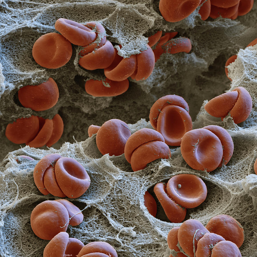 Red Blood Cells In Clot, Sem #3 Photograph by Eye Of Science