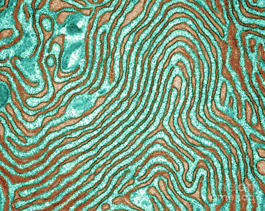 Клетки сил. Smooth endoplasmic reticulum micrograph. Endoplasmic reticulum in tireocites Electron microscopy. The smooth endoplasmic reticulum microphotograph.