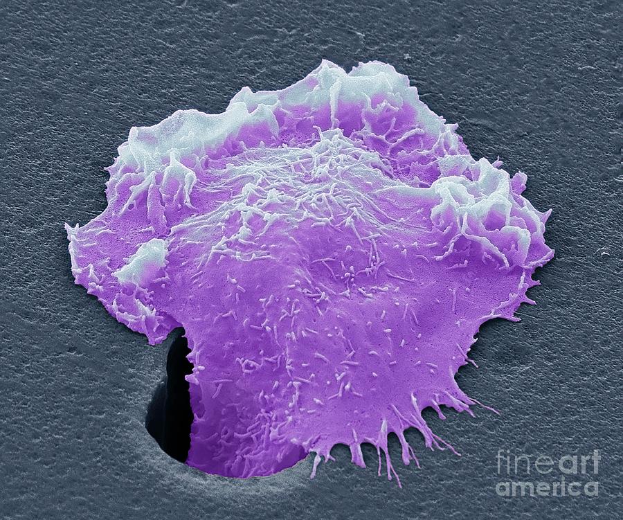 Sarcoma Cancer Cell #2 Photograph by Steve Gschmeissner/science Photo Library