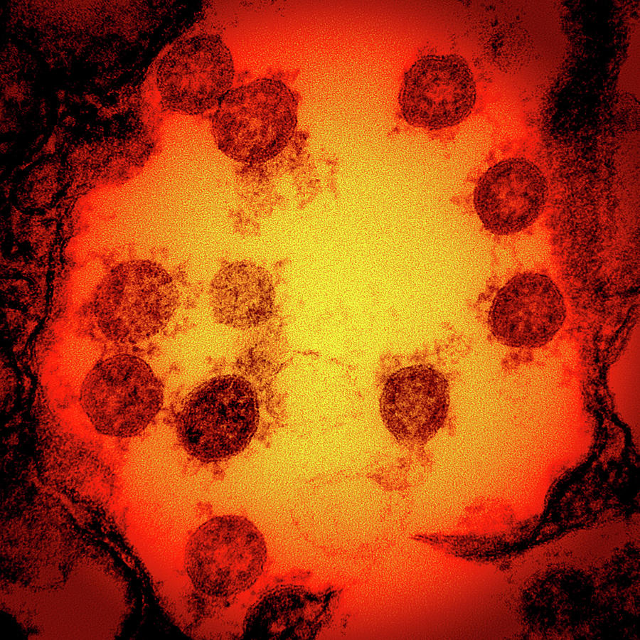 Sars-cov-2, Covid-19 Virus, Tem #2 Photograph by Science Source