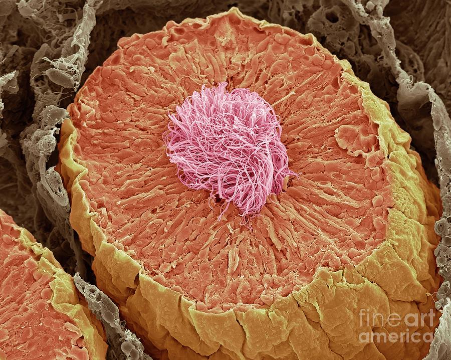 Seminiferous Tubules In The Testis #2 Photograph by Steve Gschmeissner/science Photo Library