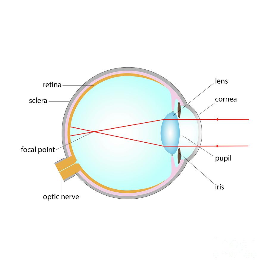 Short Sightedness Photograph by Cordelia Molloy/science Photo Library ...