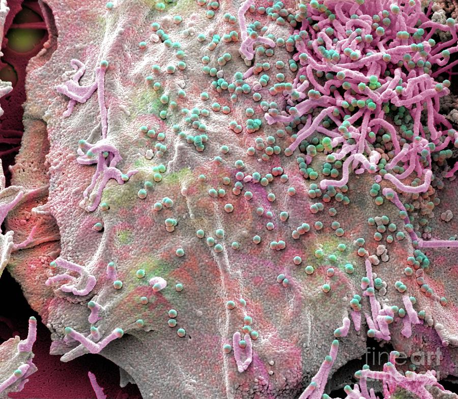 Siv Infected Cell Photograph By Steve Gschmeissnerscience Photo