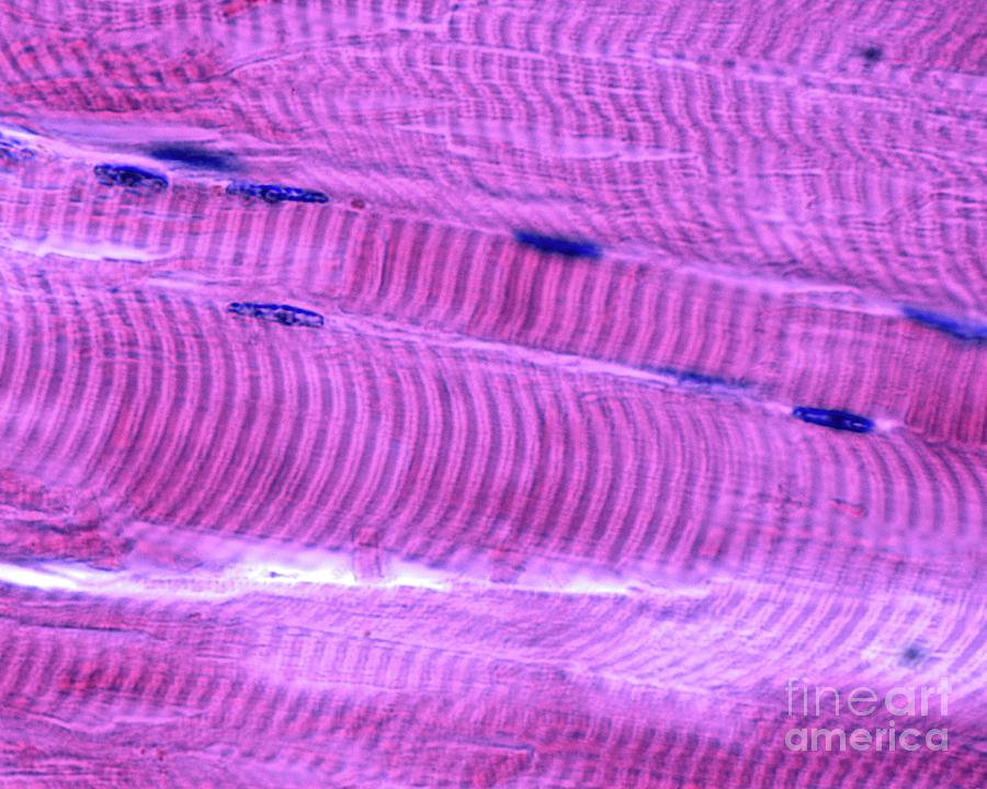 Skeletal Muscle Fibres #2 Photograph by Jose Calvo/science Photo Library