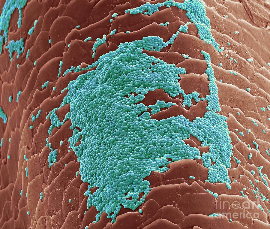 Skin Bacteria On Hair Photograph by Steve Gschmeissner/science Photo ...