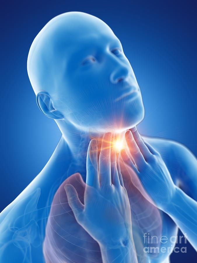 Sore Throat Photograph by Sebastian Kaulitzki/science Photo Library ...